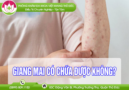 Bệnh Giang Mai Có Chữa Được Không