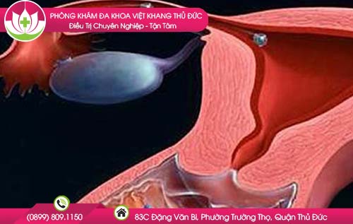 co-xat-bo-phan-sinh-duc-co-thai-khong1