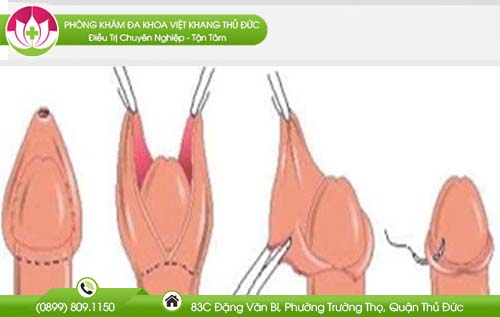 dia-chi-cat-bao-dau-dau-o-bac-lieu