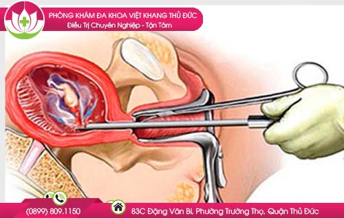 dinh-chi-thai-ky-o-thu-duc