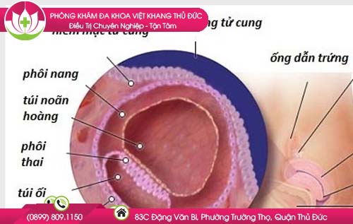 do-day-niem-mac-tu-cung-day-bao-nhieu-thi-co-thai-va-khong-co-thai