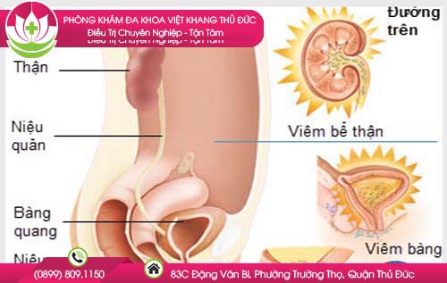 nhiem-trung-duong-tieu-o-phu-nu-khi-mang-thai-co-sao-khong