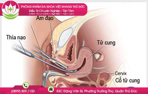 thai-16-tuan-co-pha-duoc-khong-chi-phi-bao-nhieu